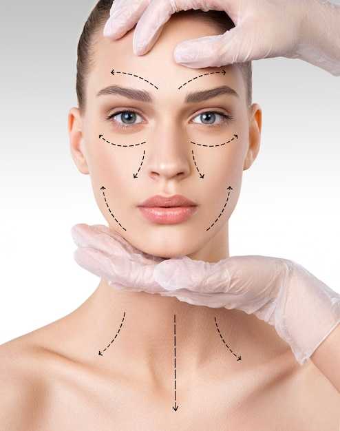 02 remodelare faciala